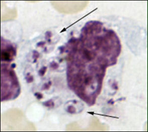 20110306-leishma cdc  bone_marrow_biopsy.jpg